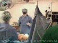 Operacja piersi