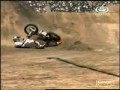 Pain of FMX