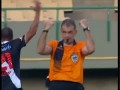 Sam sobie złamał rękę na boisku