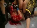 Rzeź na ringu UFC