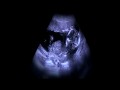 Nigdy nie wiesz kogo zabija aborcja