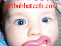 Bebe