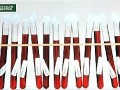 Test tubes