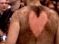 Hairless heart