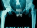 Coke