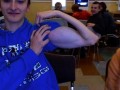 Biceps