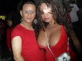 Botox fail