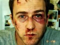 Fight club