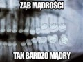 Tak bardzo