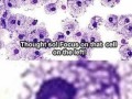 Csi