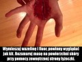 Fałszywa rana cięta