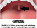 U mnie nie działa