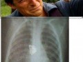 Jak mieć motyle w brzuchu