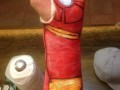 Gips dla synka