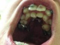 Piekło dentysty