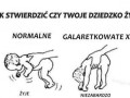 Czy dziecko żyje
