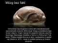 Mózg bez fałd