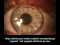 Transplantacja rogówki