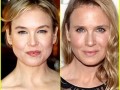 Wtf renee zellweger co się stało