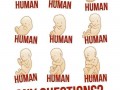 Aborcja