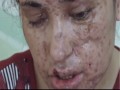 18-latka dopiero za 5 razem uciekła z niewoli ISIS
