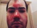 Blood Face